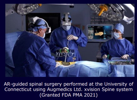 AR spinal surgery - Augmedics