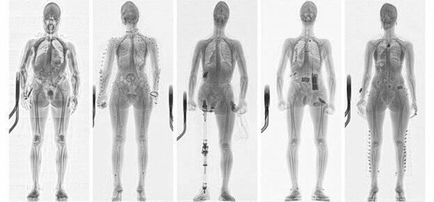 The X Factor: 125 Years of X-Ray Innovation