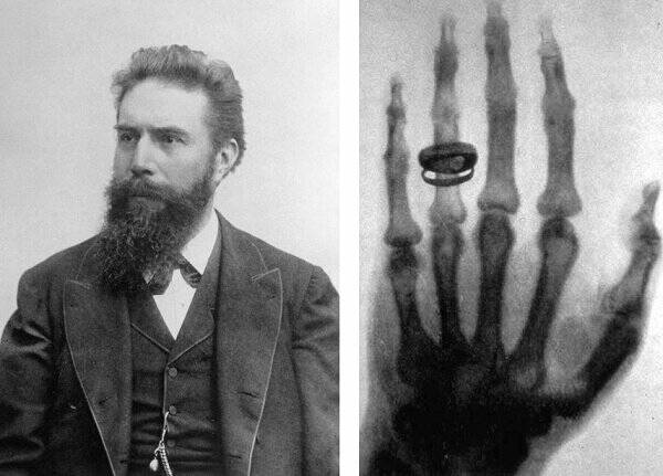 The X Factor: 125 Years of X-Ray Innovation The X Factor: 125 Years of X-Ray Innovation