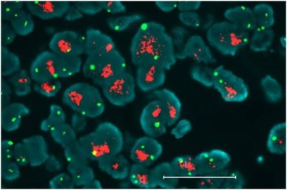 QD cancer imaging